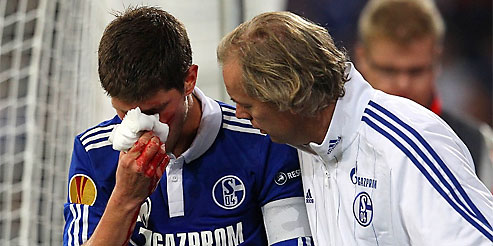 �����-�� �������� ������� ������ � ����� ������ ����